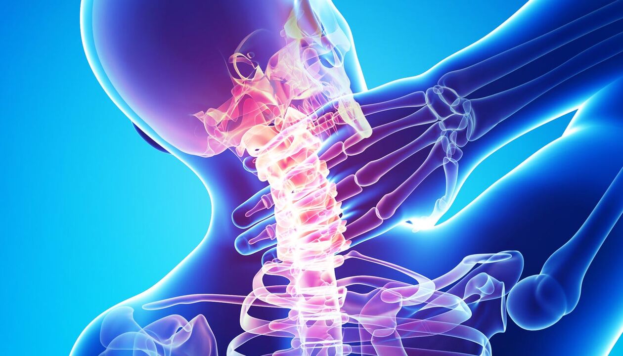 nekpijn als gevolg van osteochondrose