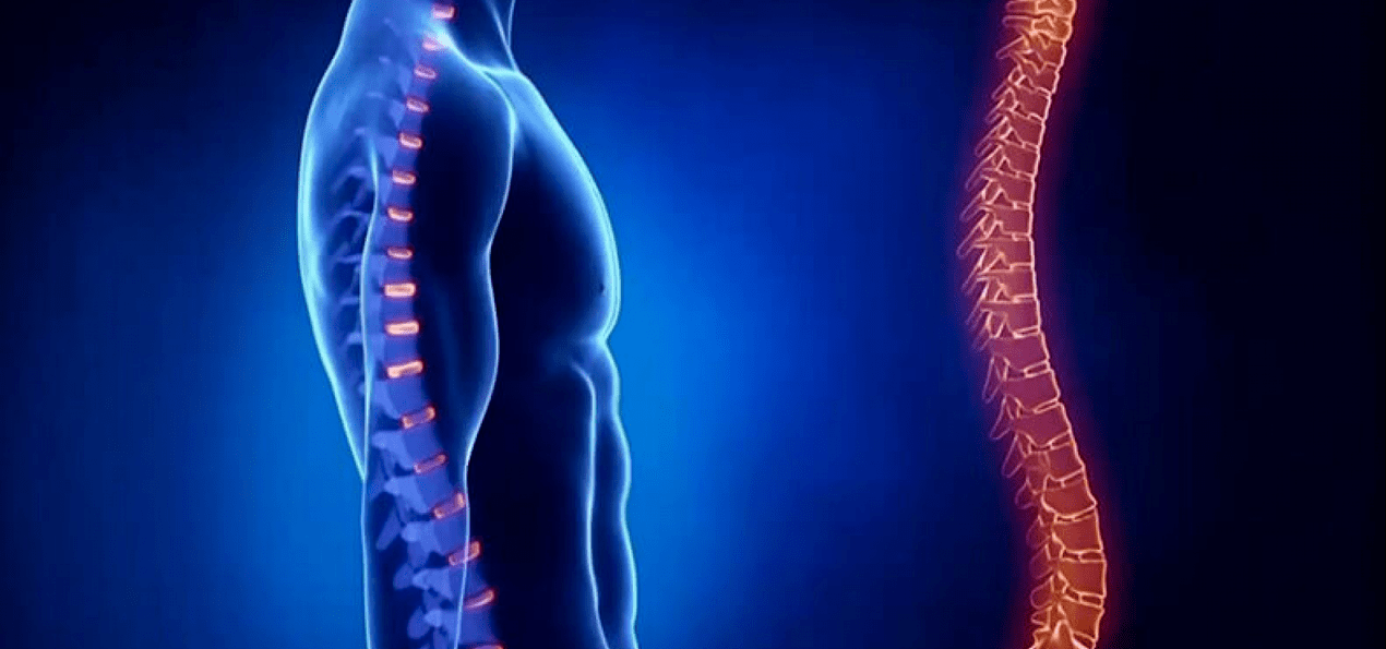 spinale laesies als gevolg van osteochondrose